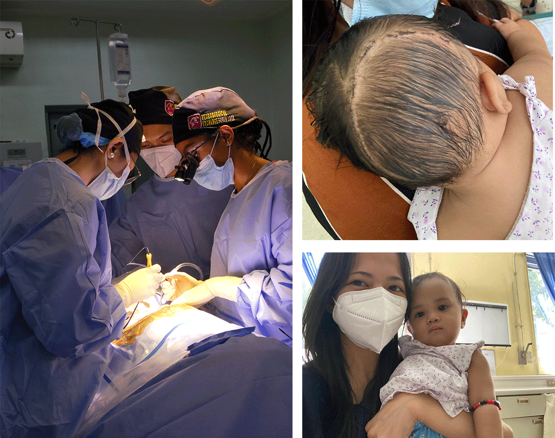 Collage of a Surgery and a Child After the Operation
